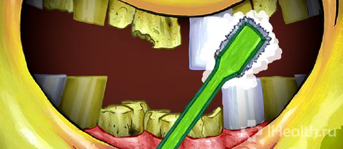 7 способів прибрати зубний камінь в домашніх умовах