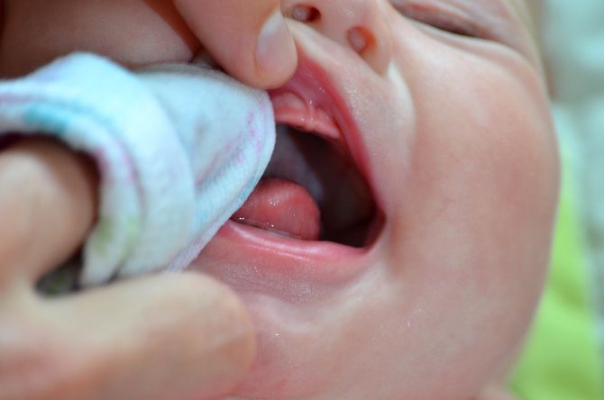 Білий наліт на язиці у дітей: всі 4 причини з фото і лечиние
