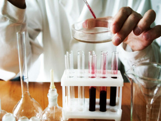 Біохімічне дослідження крові: що це таке, показання до здачі аналізу