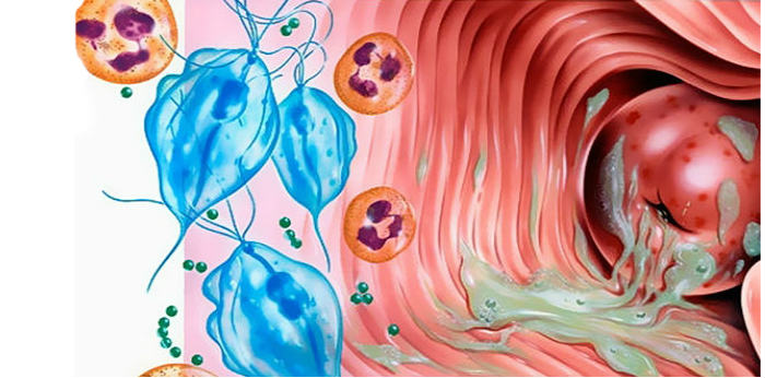 Бактеріальний вагініт: причини, симптоми і лікування