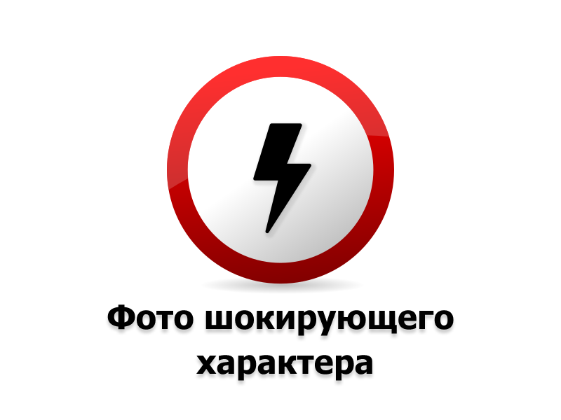 Баланіт у жінок: причини появи та основні методи лікування кандидозу