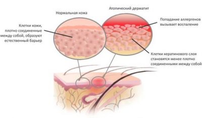 Докладна інструкція із застосування мазі Тридерм