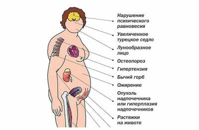 Докладна інструкція із застосування мазі Тридерм