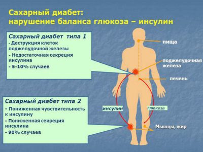 Фурункул і фурункульоз: причини, симптоми і лікування