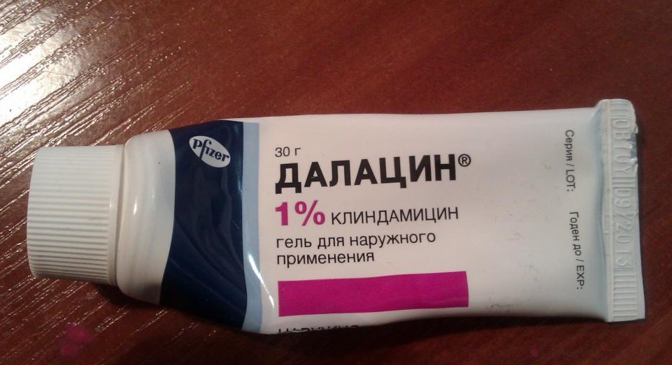 Гарднерелла у чоловіків: всі причини, симптоми, способи лікування