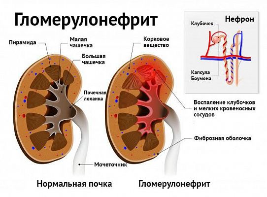 Кров у сечі у жінок – всі причини і можливі хвороби