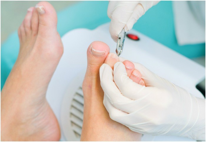 Нарывает палець на нозі біля нігтя – причини з фото, лікування в домашніх умовах
