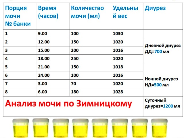 Ниркова недостатність — патологія, що призводить до збою в усьому організмі