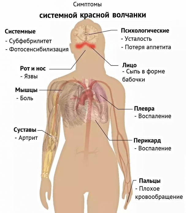 Інтерстиціальний нефрит: як лікувати патологію