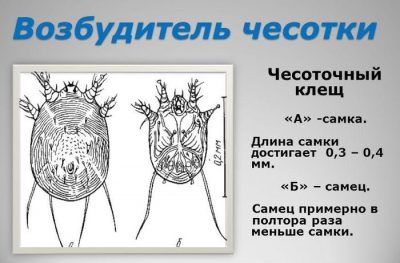 Ознаки, симптоми та особливості лікування корости у дитини