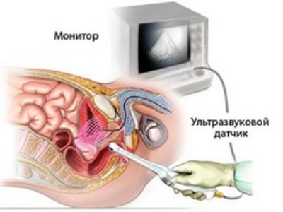 Підготовка до УЗД передміхурової залози: основні етапи