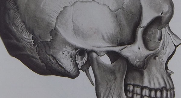 Перелом основи черепа: ознаки, лікування, наслідки