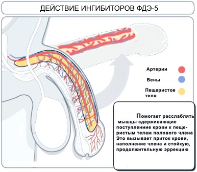 Силденафіл: як він діє і дійсно покращує потенцію