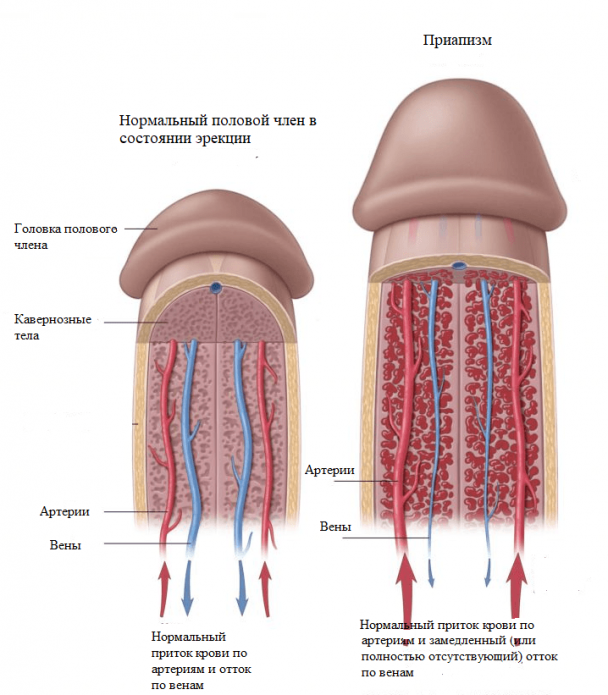 Все, що потрібно знати про приапізмі
