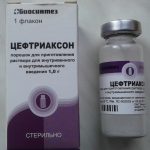 Захворювання нирок: особливості патологій у чоловіків